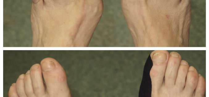 Medicīniskā teipošana