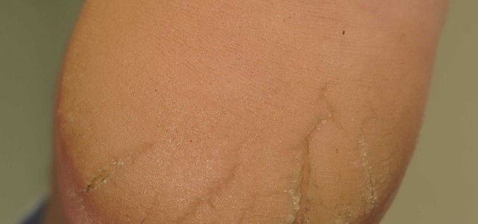 Plaisājoši papēži