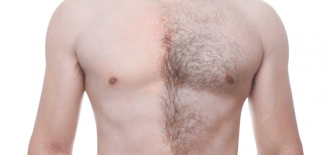 Izlasi pirms došanās uz lāzerepilācijas procedūru