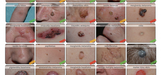 Ādas veidojumu atlants