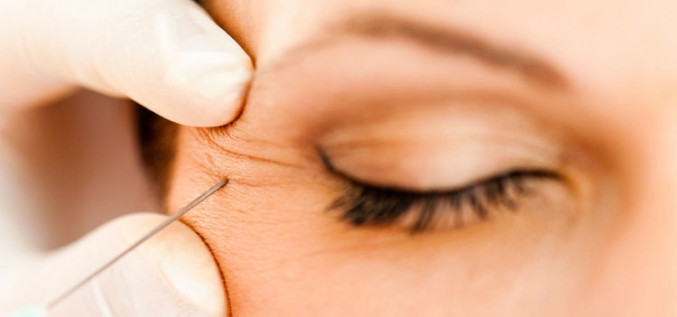 Botulīna toksīna injekcijas