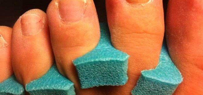 Kājas nags mainījis krāsu un deformējies