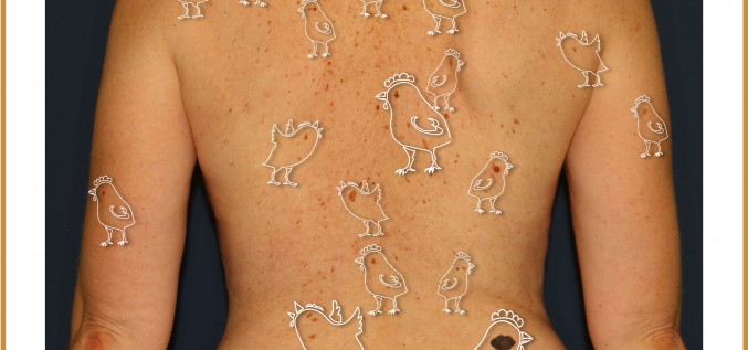 Cāļus skaita rudenī – ādas veidojumus arī!