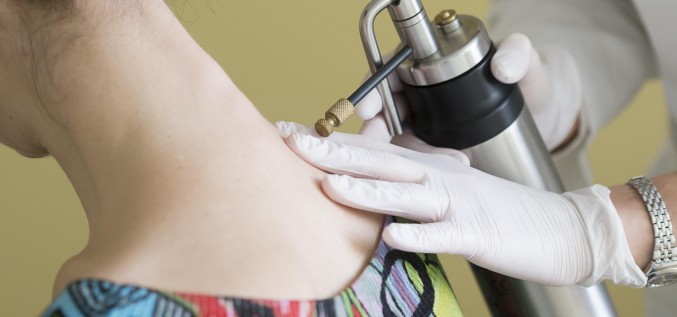 Криотерапия